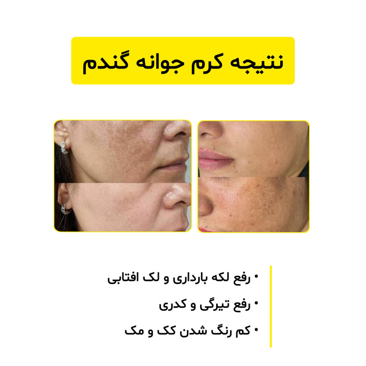 پک کرم جوانه گندم ویتابلا جوانساز و روشن کننده