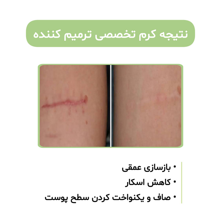 کرم بیوممتیک ۵ کاره گاتیو کلاژن ساز ضداسکار ترمیم کننده