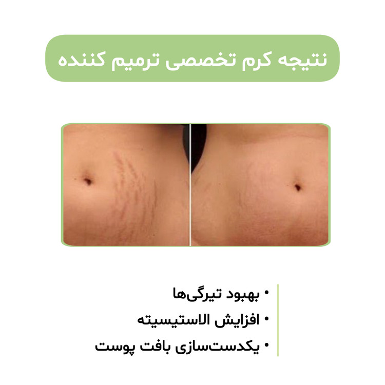 کرم بیوممتیک ۵ کاره گاتیو کلاژن ساز ضداسکار ترمیم کننده