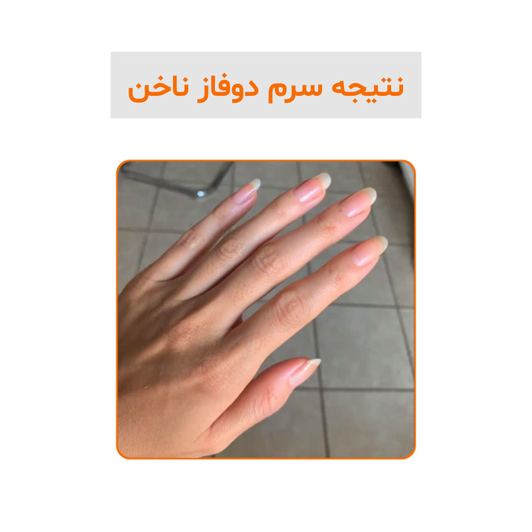 سرم دوفاز تقویتکننده و ترمیمکننده ناخن ویتابلا اصل