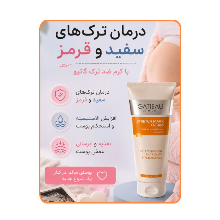 کرم رفع ترک گاتیو استرچ مارک ترمیم خطوط بارداری و لاغری